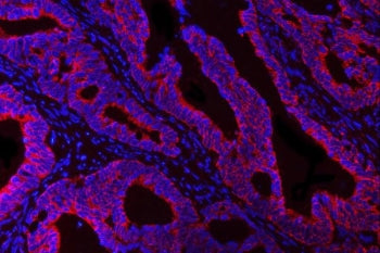 HBEGF Antibody / DT-R