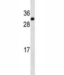 IGF2 Antibody