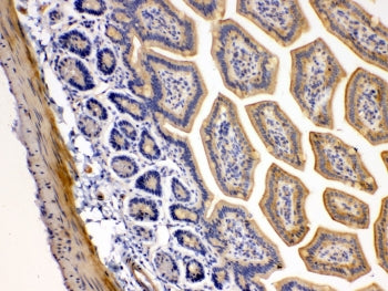 TRAIL R2 Antibody (DR5)