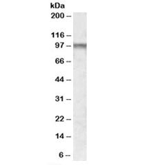 Western blot testing of human frontal cortex lysate with CPT1C antibody at 1ug/ml. Predicted molecul