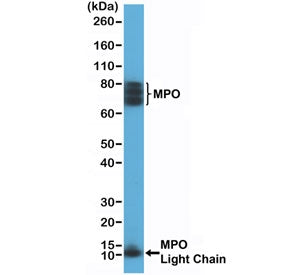 Myeloperoxidase Antibody / MPO