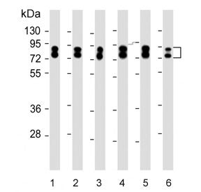 Western blot testing of human 1) 293T, 2) A431, 3) A549, 4) HepG2, 5) MOLT4 and 6) U-251 MG cell lys