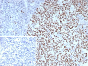 IHC staining of FFPE human tonsil tissue with BCL-6 antibody (clone BCL6/8983R). Inset: PBS used in 