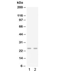 Gro gamma Antibody / Cxcl3