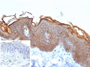 IHC staining of FFPE human skin tissue with S100A16 antibody (clone S100A16/7412). Inset: PBS used i