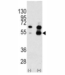 Western blot analysis of VEGFA antibody and 293 cell lysate either nontransfected (Lane 1) or transi