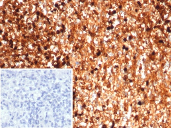 IHC staining of FFPE human spleen tissue with S100A9 antibody (clone S100A9/7553). Inset: PBS used i