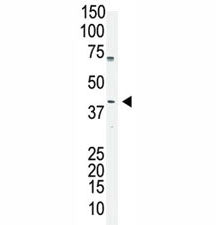 Oct4 antibody used in western blot to detect OCT4 in A375 cell lysate. Predicted molecular weight ~3