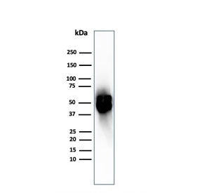 Western blot testing of human spleen tissue with recombinant Thymidine Phosphorylase antibody. Predi