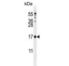 Western blot testing of mouse NIH 3T3 cell lysate with IQCJ antibody. Predicted molecular weight ~18