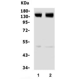 Western blot testing of 1) rat brain and 2) mouse brain lysate with GRM5 antibody. Expected molecula
