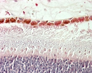 IHC staining of FFPE human retina with RDH5 antibody at 5ug/ml. HIER: steamed with pH6 citrate buffe