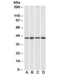 Western blot testing of human HeLa [A], HepG2 [B], Jurkat [C] and mouse NIH3T3 [D] nuclear lysate wi