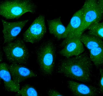 Immunofluorescent staining of RBCK1 using anti-RBCK1 antibody (green). RBCK1 was detected in an immu