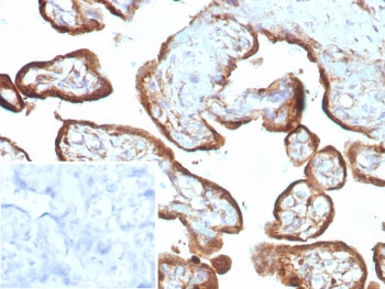 IMP3 Antibody / Insulin like growth factor 2 mRNA binding protein 3