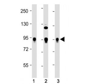 Western blot testing of Wee1 antibody at 1:2000: Lane 1) human HeLa, 2) Jurkat and 3) K562 cell lysa