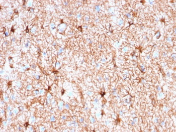 IHC testing of FFPE human cerebellum tissue with recombinant Glial Fibrillary Acidic Protein antibod