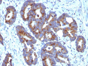 ABO Antibody (Blood Group Antigen A)