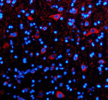 Immunofluorescent staining of TIM10/TIMM10 using anti-TIMM10 antibody (red). TIM10/TIMM10 was detect