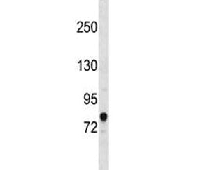 Western blot testing of human HepG2 cell lysate with ACSL3 antibody at 0.5ug/ml. Predicted molecular