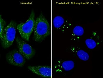Fluorescent image of U251 cells stained with anti-ATG5 antibody diluted at 1:25 dilution. U251 cells