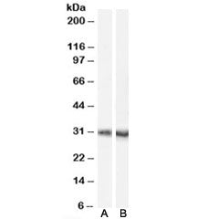 Western blot testing of mouse brain lysate with A) Dcdc2a antibody, cat # R35120 (0.1ug/ml) and B) <