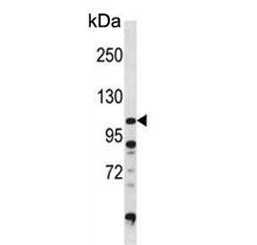 Western blot testing of human Ramos cell lysate with DGKZ antibody. Predicted molecular weight ~104 