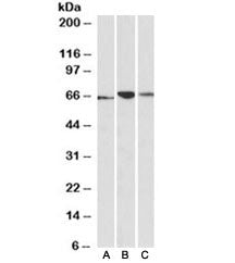 Western blot testing of human [A], mouse [B] and rat [C] pancreas lysates with PDIA2 antibody at 0.1