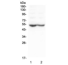 Dopamine Receptor D5 Antibody
