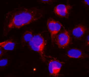 Immunofluorescent staining of FFPE human U-2 OS cells with CCNB1 antibody (red) and DAPI nuclear sta