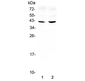 Western blot testing of 1) rat brain and 2) mouse brain lysate with Amphiregulin antibody at 0.5ug/m