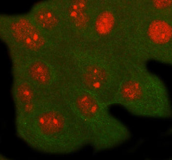 Immunofluorescent staining of RFXANK using anti-RFXANK antibody (red) and anti-Beta Tubulin antibody