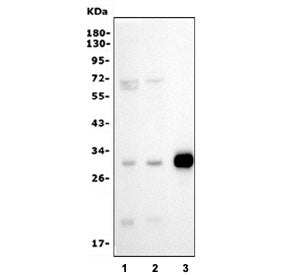 Western blot testing of 1) human HEK293, 2) human PC-3 and 3) rat spleen lysate with Purine nucleosi