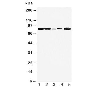 Western blot testing of FGFR1 antibody and Lane 1: rat liver; 2: rat brain; 3: SMMC-7721; 4: HT1080;