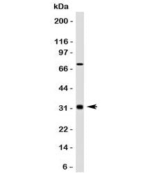 Western blot testing of Bcl10 antibody (clone MUBC10) and HepG2 lysate. Observed molecular weight: 2