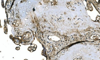 IHC staining of FFPE human placenta with OTULIN antibody. HIER: boil tissue sections in pH8 EDTA for