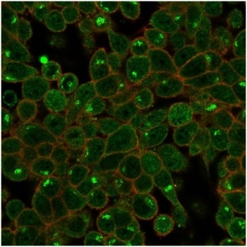 ZSCAN2 Antibody