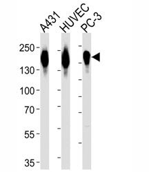 Western blot analysis of lysate from A431, HUVEC, PC3 cell line (left to right) using anti-EGFR anti