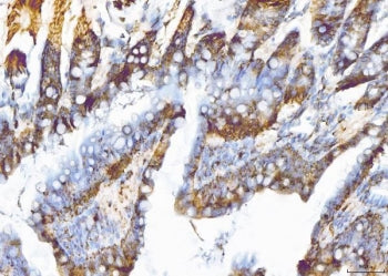IHC staining of FFPE rat colon tissue with Eukaryotic translation initiation factor 5A-1 antibody. H