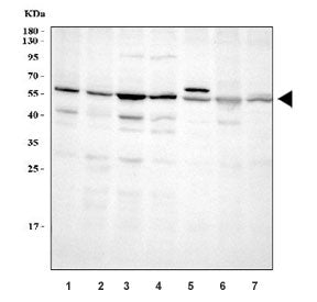 ABI2 Antibody