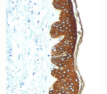 Basic Cytokeratin Antibody (HMW / Type II)