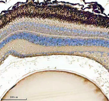 IHC staining of FFPE zebrafish eye tissue with Zebrafish Gnb1 antibody. HIER: boil tissue sections i