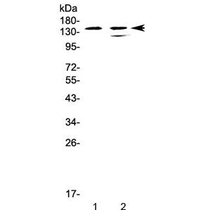 Western blot testing of human 1) CCRF-CEM and 2) SW620 cell lysate with SHIP1 antibody at 0.5ug/ml. 