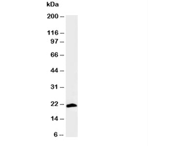 Western blot testing of Myosin antibody and rat skeletal muscle tissue lysate