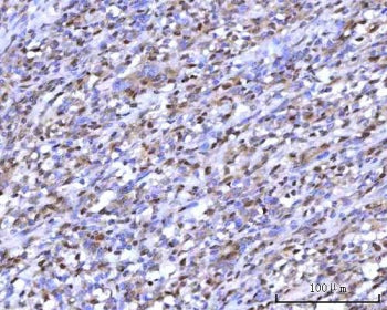 mRNA-capping enzyme Antibody / RNGTT / HCE