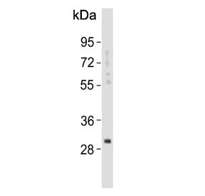 Western blot testing of human lung tissue lysate with KLK6 antibody. Predicted molecular weight ~27 