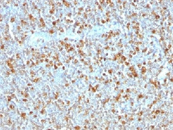 Alpha 1 Antitrypsin Antibody / AAT / SERPINA1