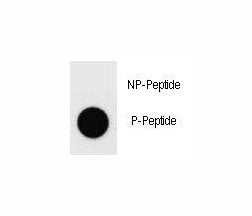 Dot blot analysis of phospho-Dnmt1 antibody. 50ng of phos-peptide or nonphos-peptide per dot were sp