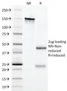 Erythropoietin Antibody / EPO