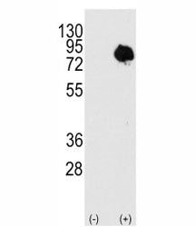 Western blot analysis of TG2 antibody and 293 cell lysate (2 ug/lane) either nontransfected or trans
